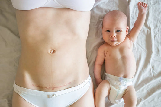 This Is Why Skin-to-Skin Contact After a C-Section Is Crucial