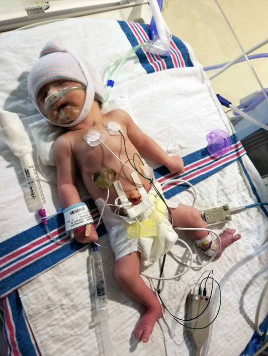 World Prematurity Day: Cassandra’s Story