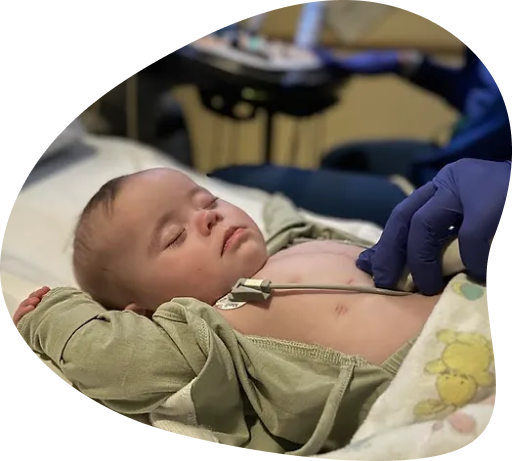 baby-in-NICU-being-monitored